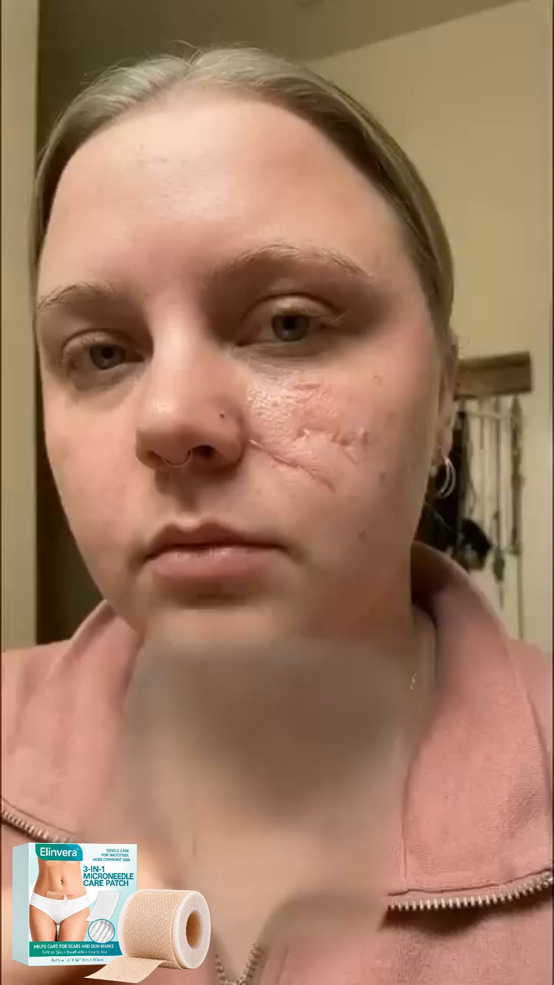 98.6% Clinically Proven Scar Removal