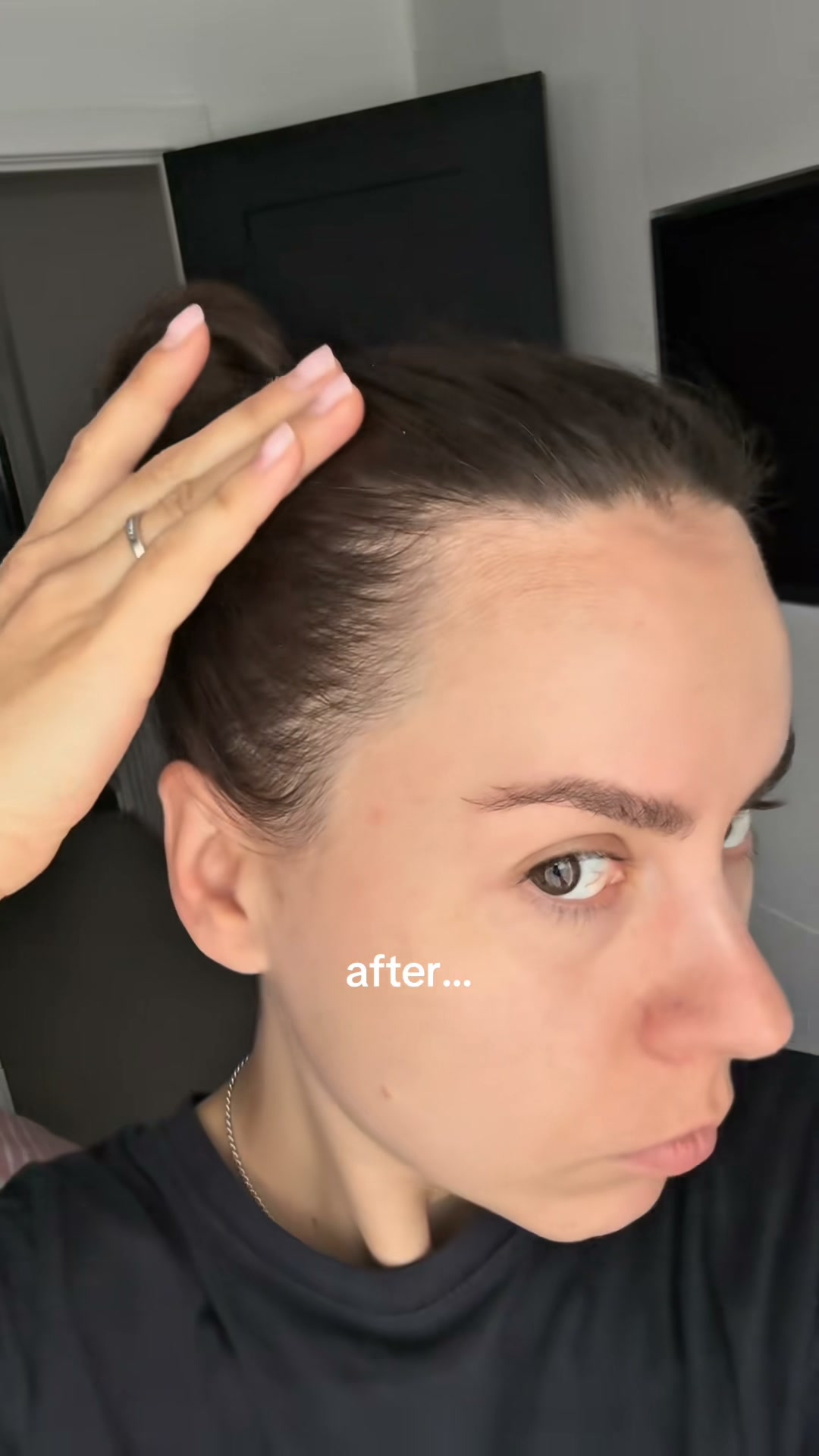 Korea's #1 Hair Growth Serum