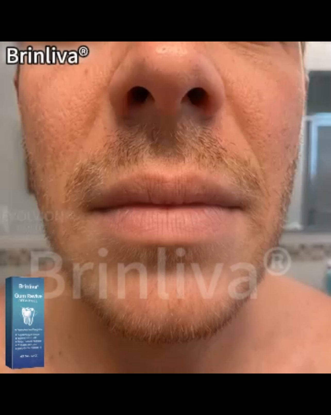 Nourish Your Gums, Reveal Your Smile