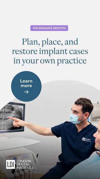 Keep implant cases in-house