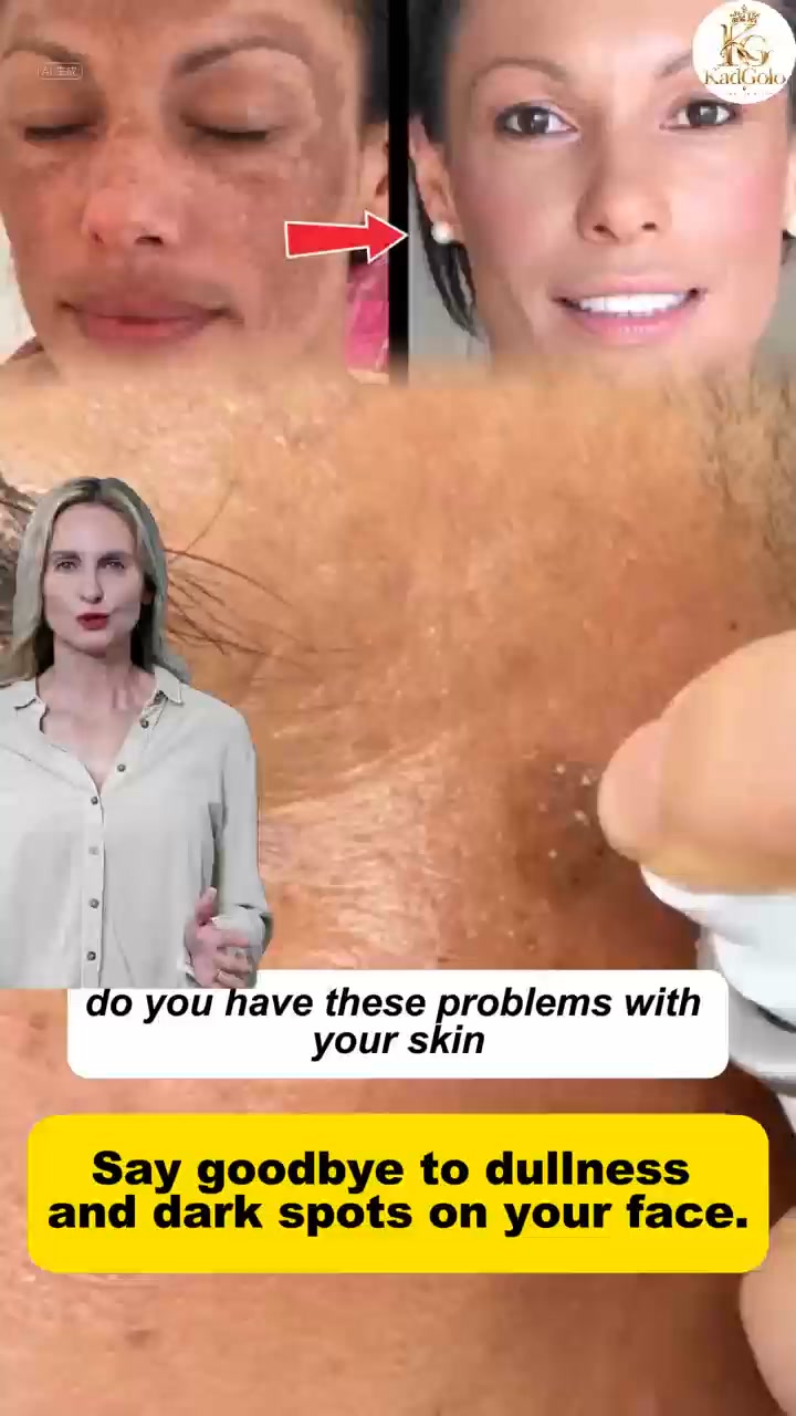 PDRN + Peptides for a Fresh Glow