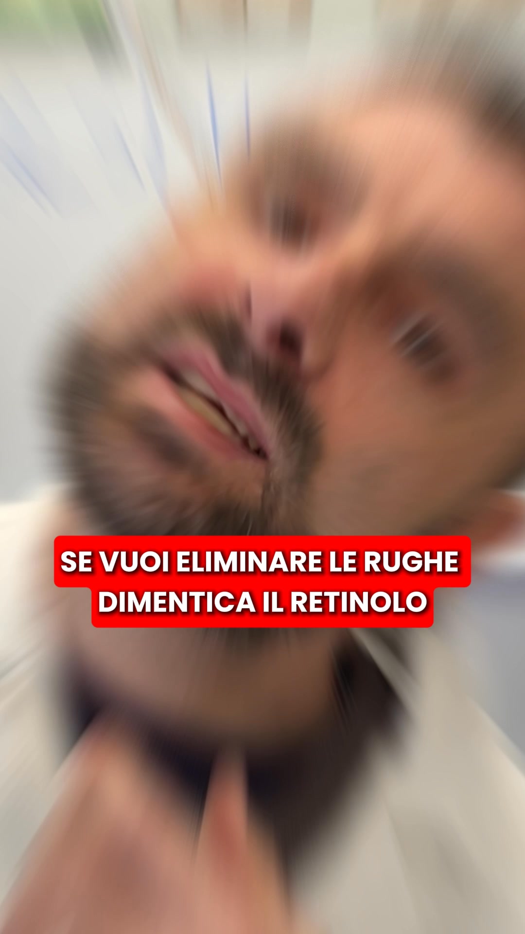 Scopri il kit di micro-infusione di Renovae