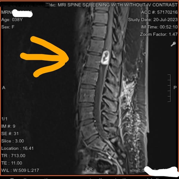 This is what they don’t tell you about sciatica.