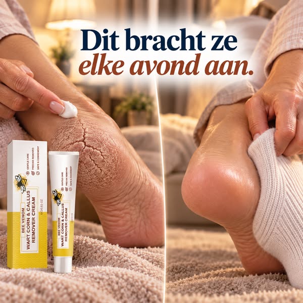 Van Ruwe Naar Zichtbaar Gladdere Voeten >>