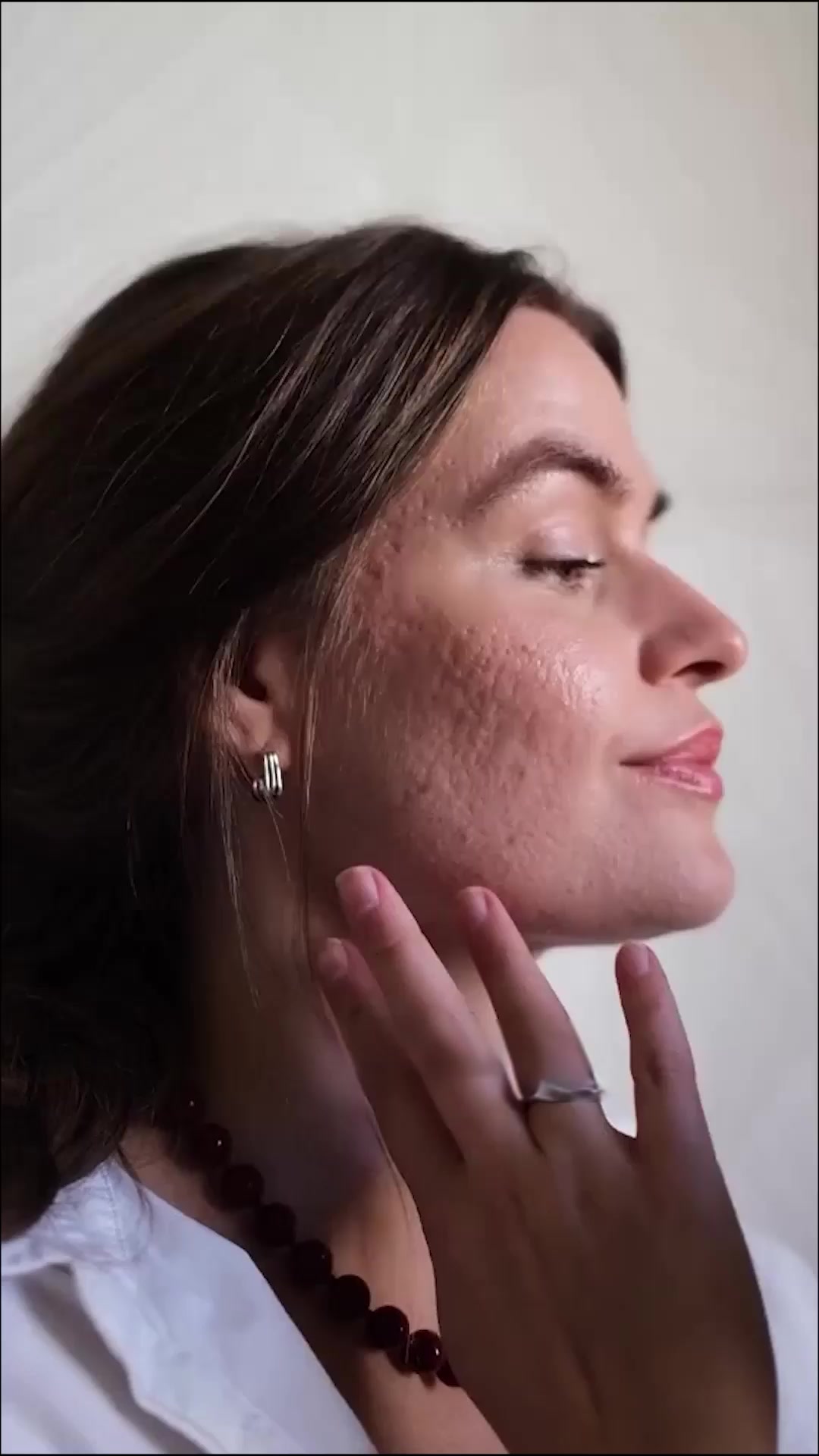 Fastest Way To Fade Acne Scars