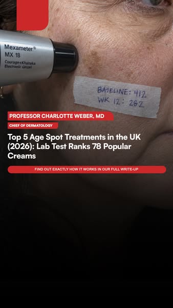 Top 5 Age Spot Treatments in the UK (2026): Lab Test Ranks 78 Popular Creams