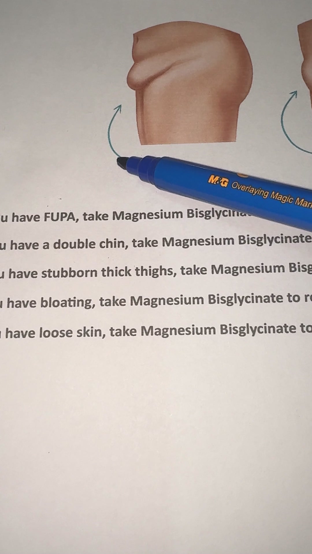 Advertorial - Magnesium