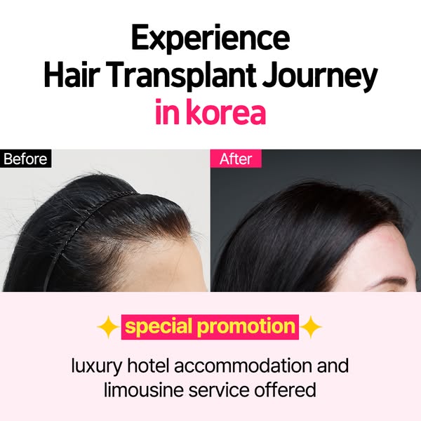Dream Hairline Hair Transplant