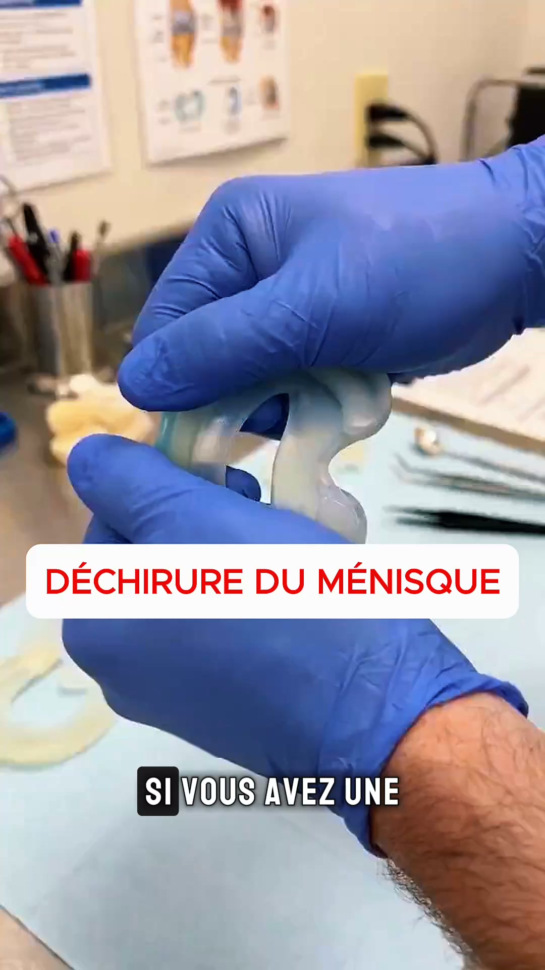 Douleurs au genou ou arthrose ?