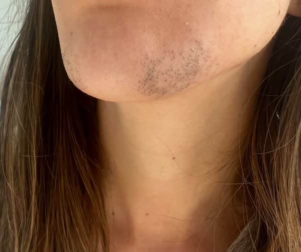 Read this if you're shaving your face daily
