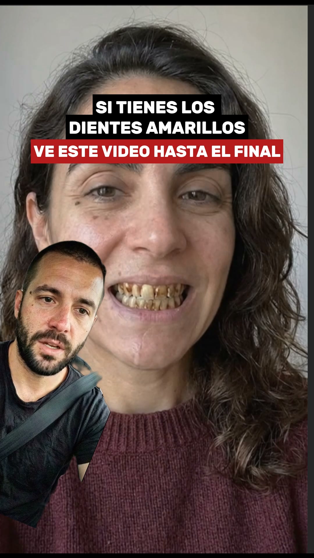 Unidades Limitadas