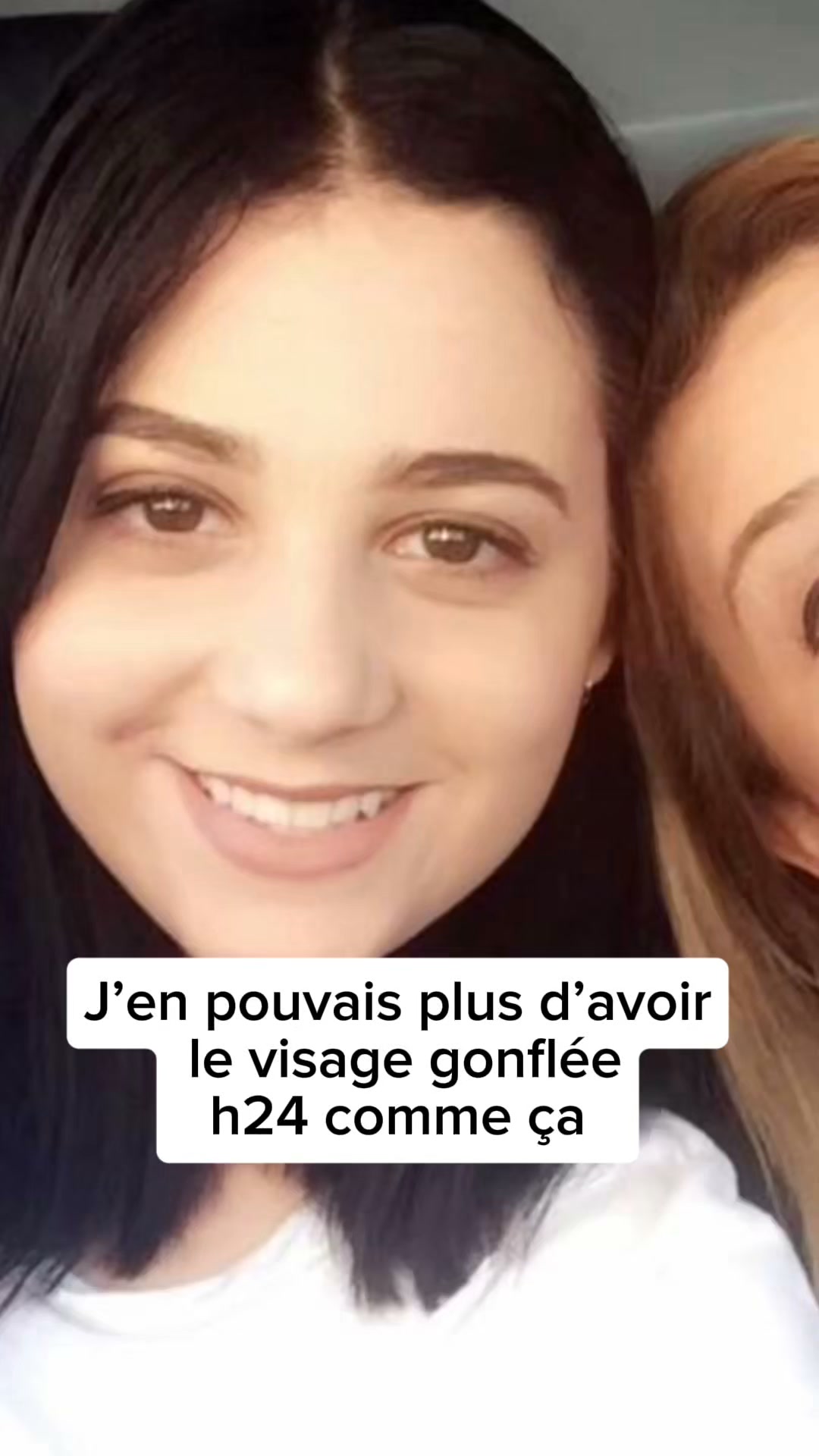 Ventre gonflé, visage bouffi : cible aussi le cortisol