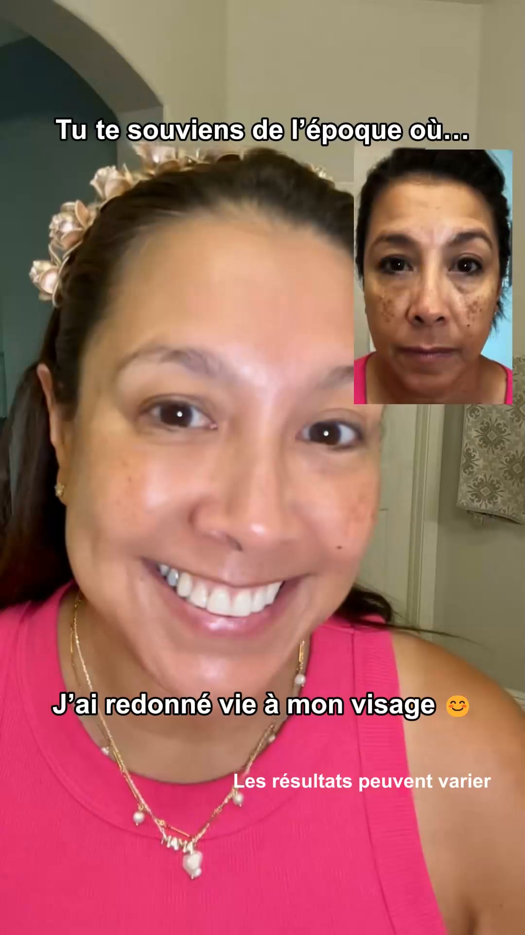Un teint plus uniforme, jour après jour