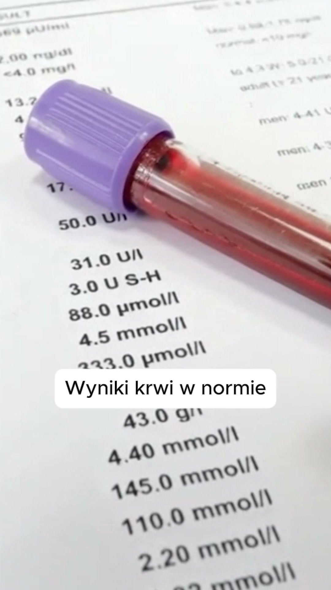 Poznaj przełomową kuracje na porost włosów