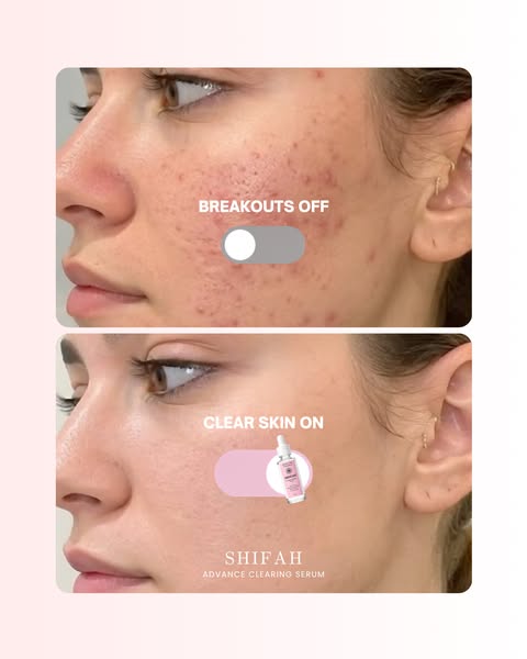 Brighter, Clearer-Looking Skin