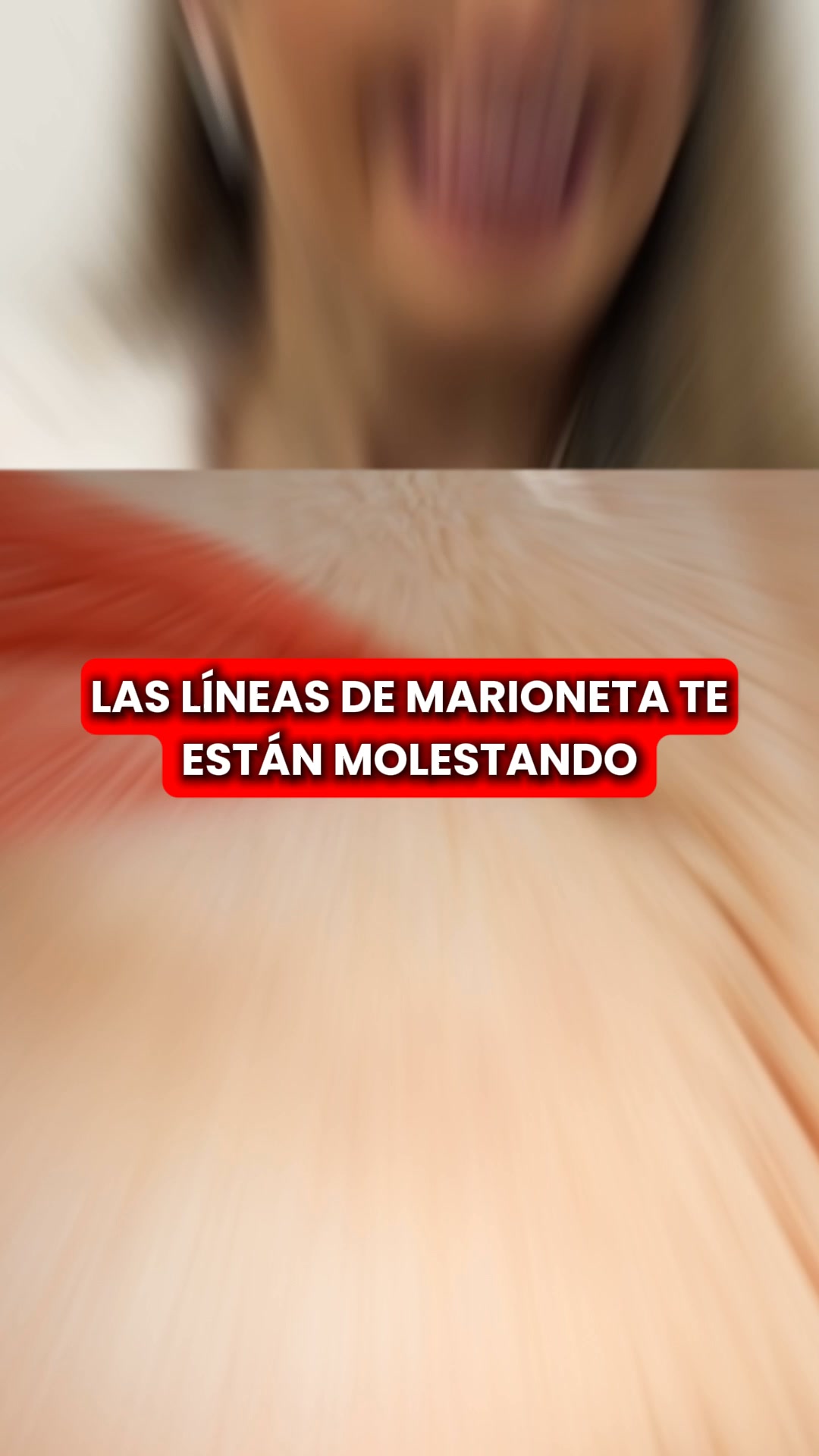 Descubre la micro-infusión Renovae