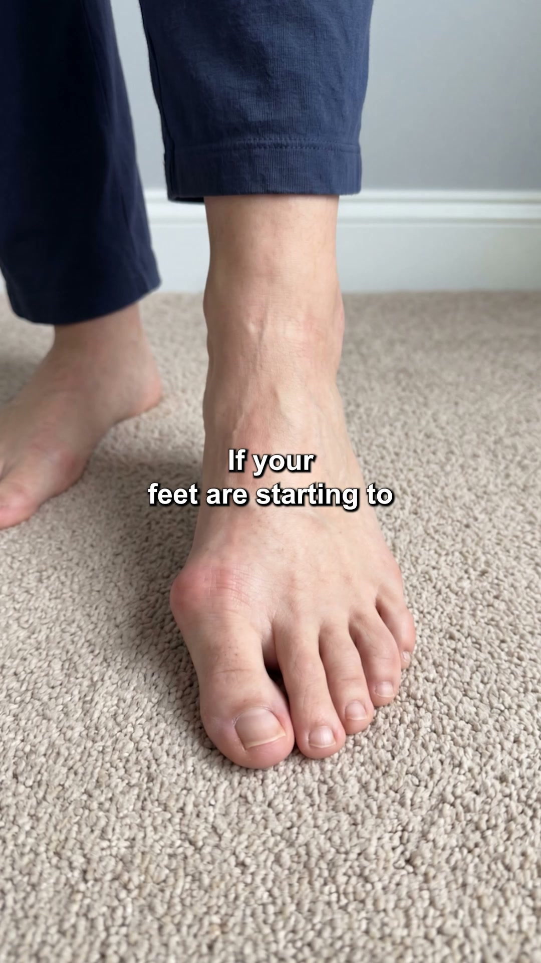 If you cut a bunion off, it grows back