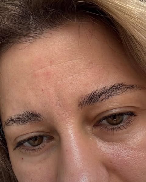 Anúncio de Miyo