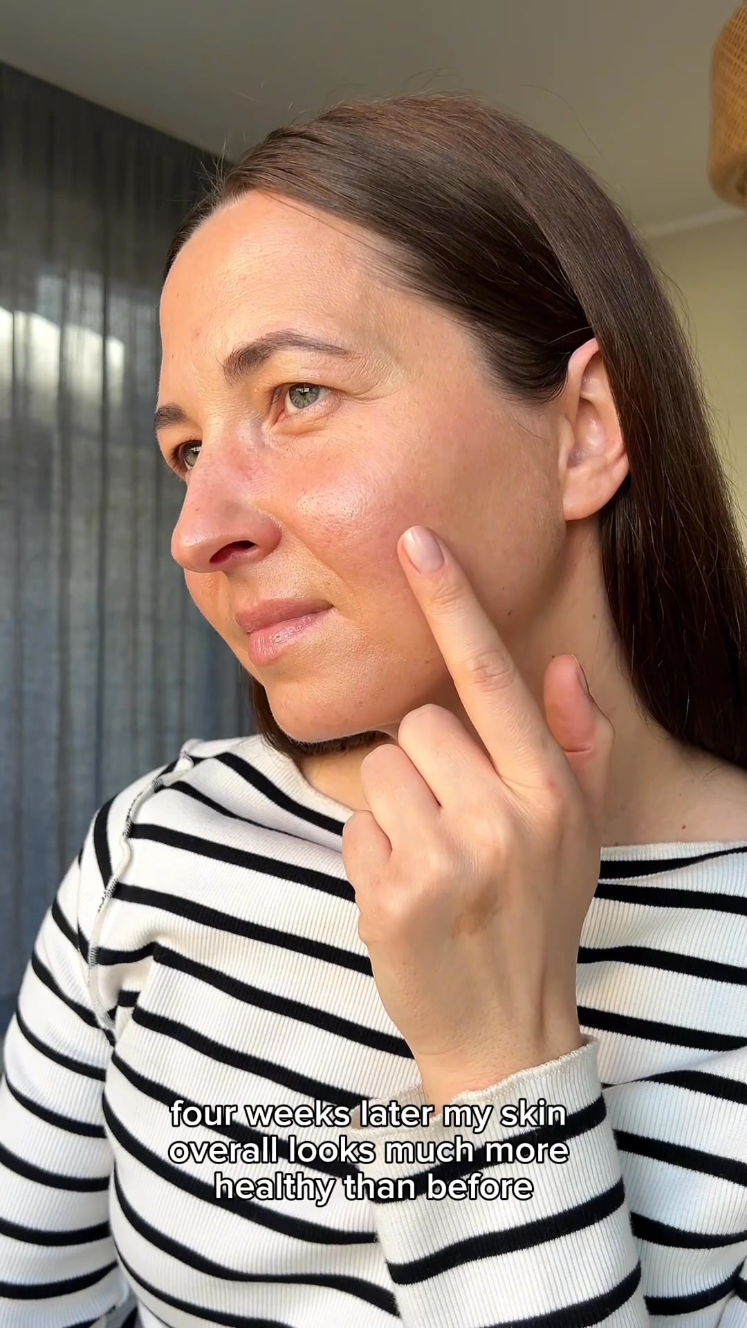 The science of balanced skin