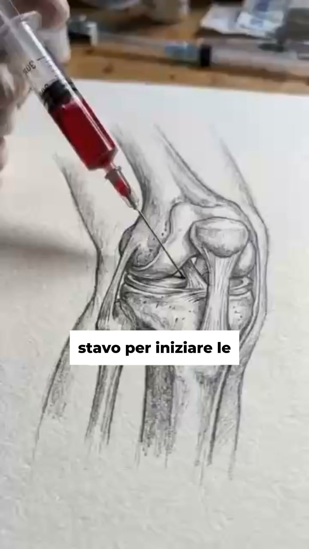 Addio dolore articolare in 60 giorni!