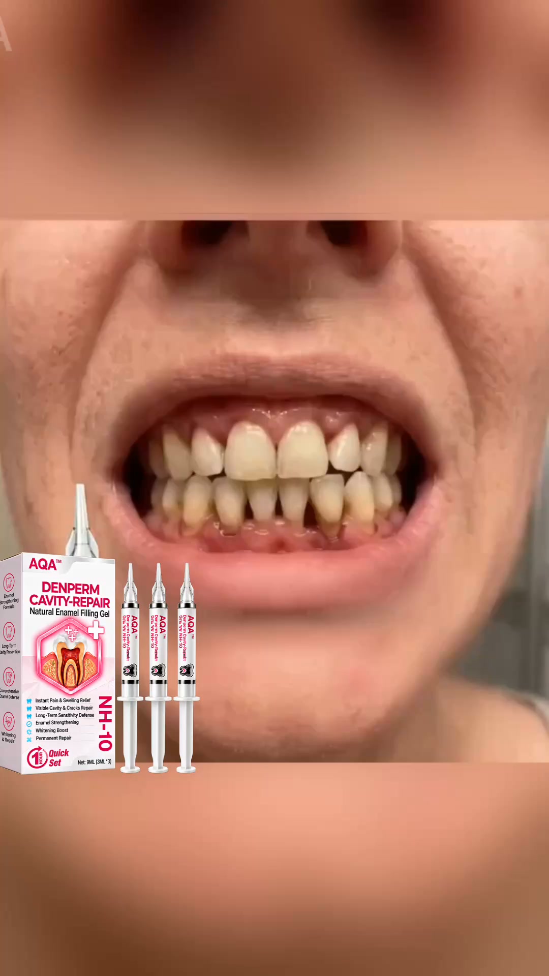 Cavity Repair FDA-Recognized 10% Nano-Hydroxyapatite (NH-10)| Delivery within 2-4 working days| Full refund guarantee