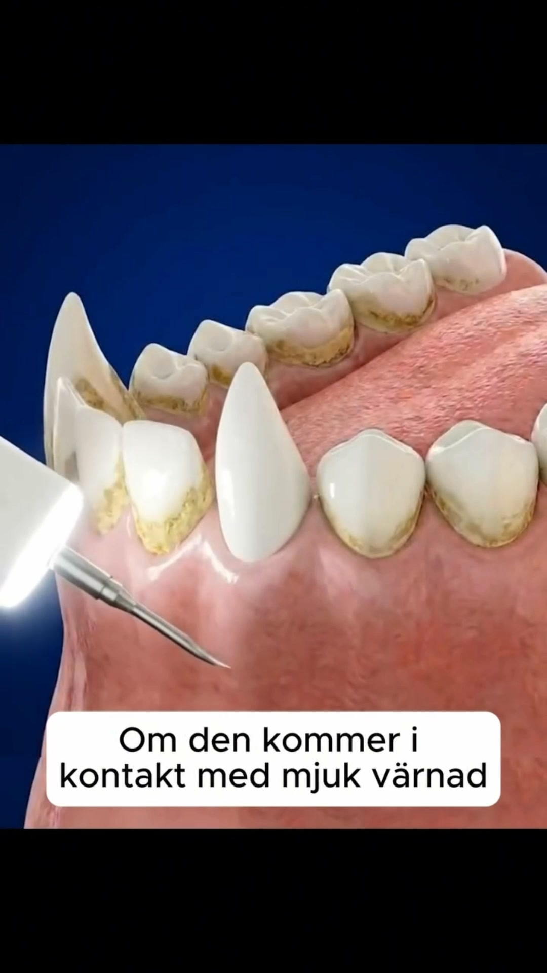 Lenhy Kit – Tyst ultraljudsbaserad tandstens- och plackborttagare för hundar