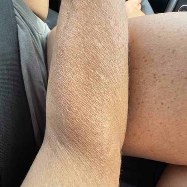 Dermatologist Said There Was Nothing to Be Done. She Was Wrong