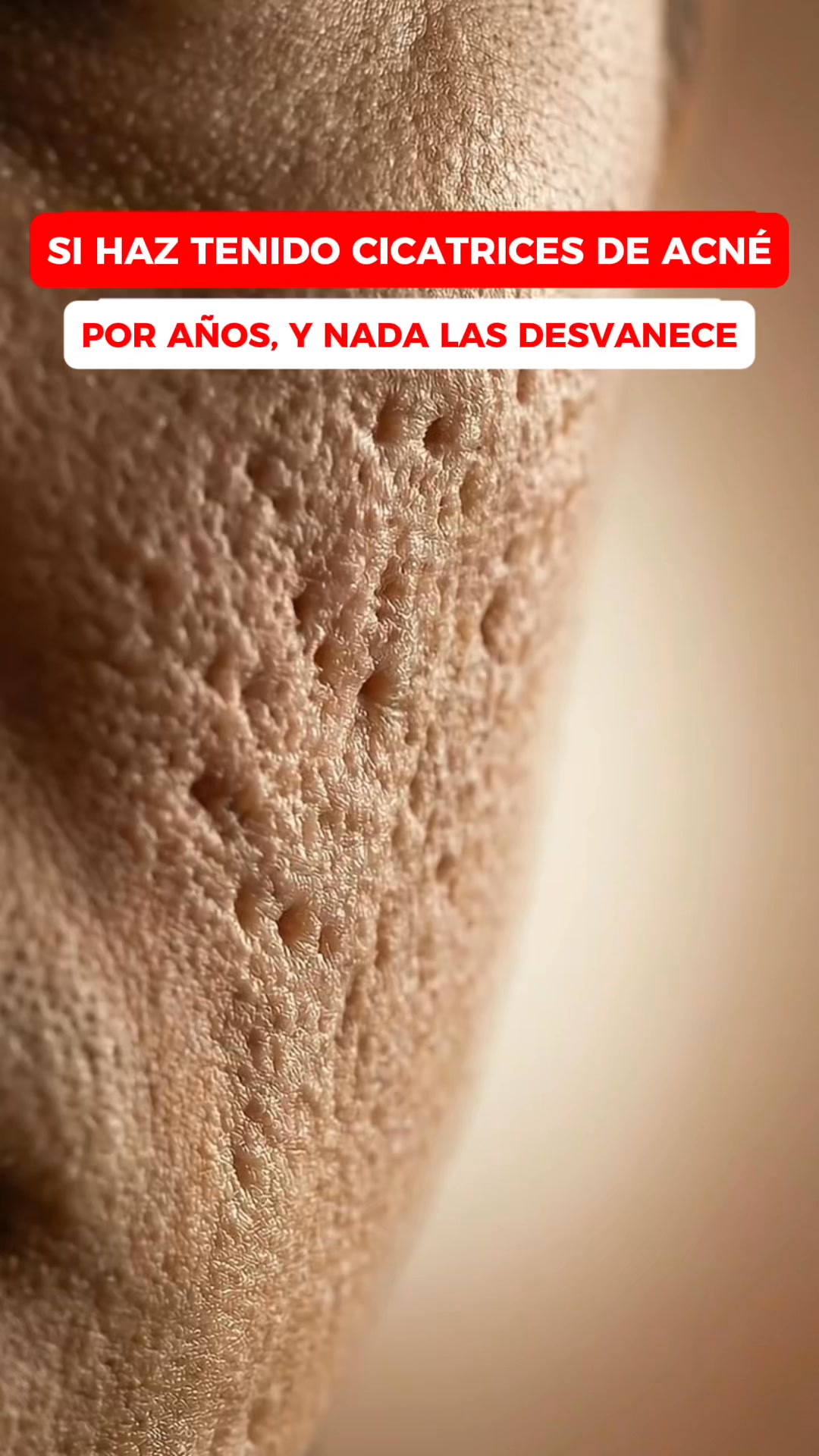 Si Tienes Marcas Mira Esto