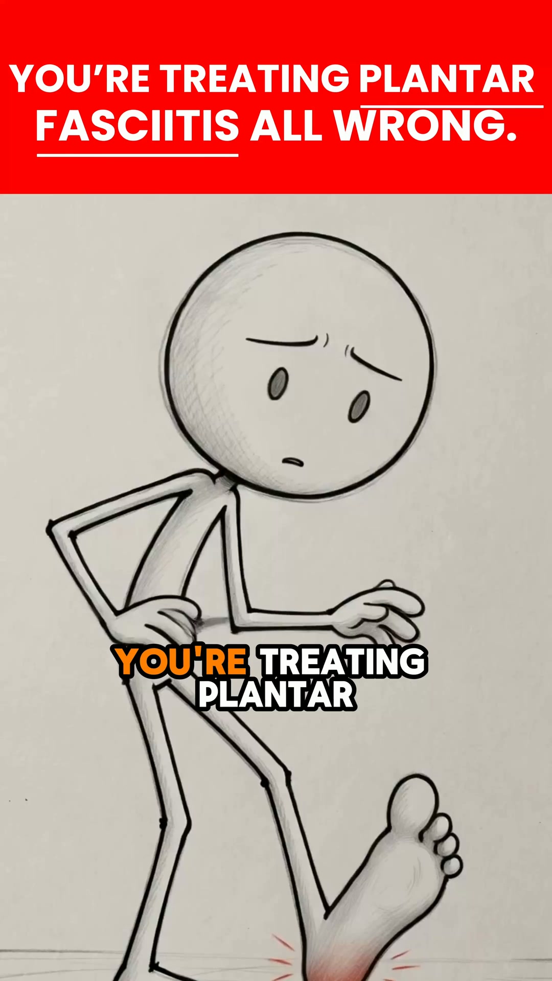 Plantar Fasciitis, Explained With Stick Figures