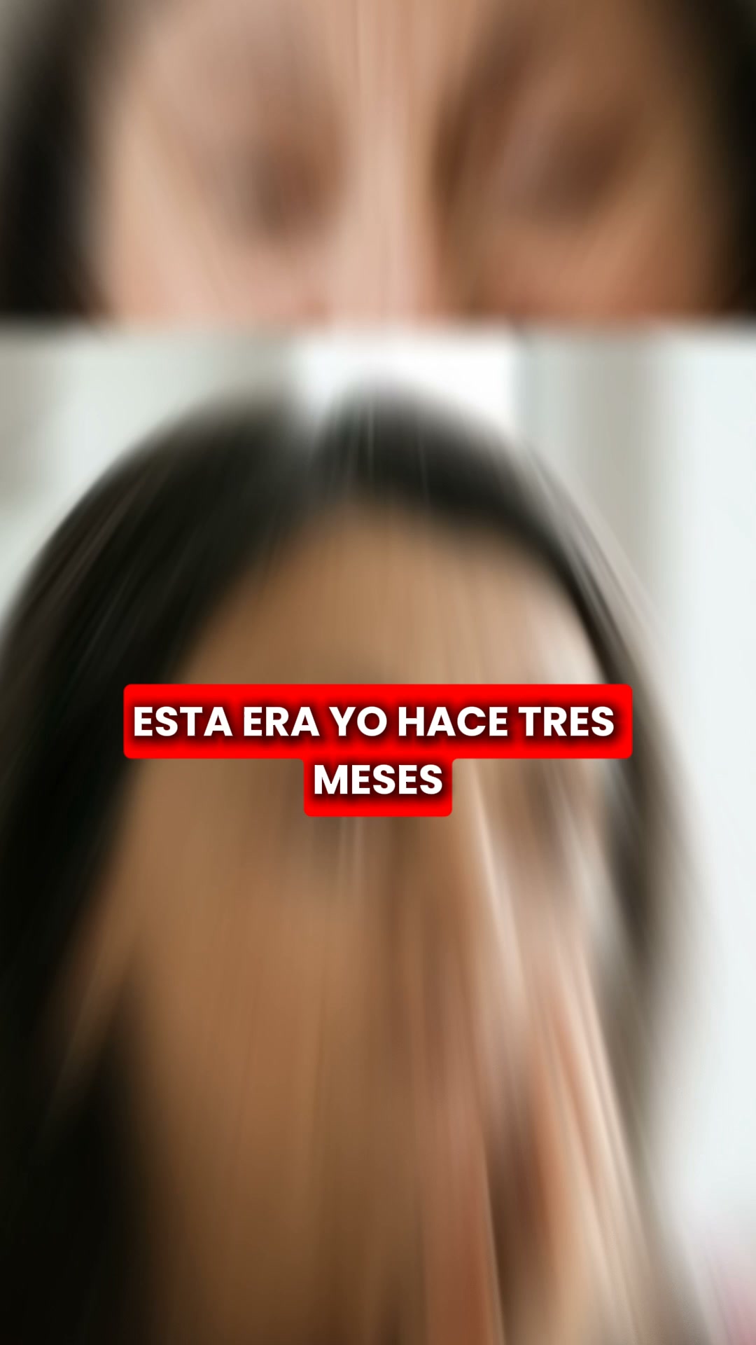Descubre la micro-infusión Renovae