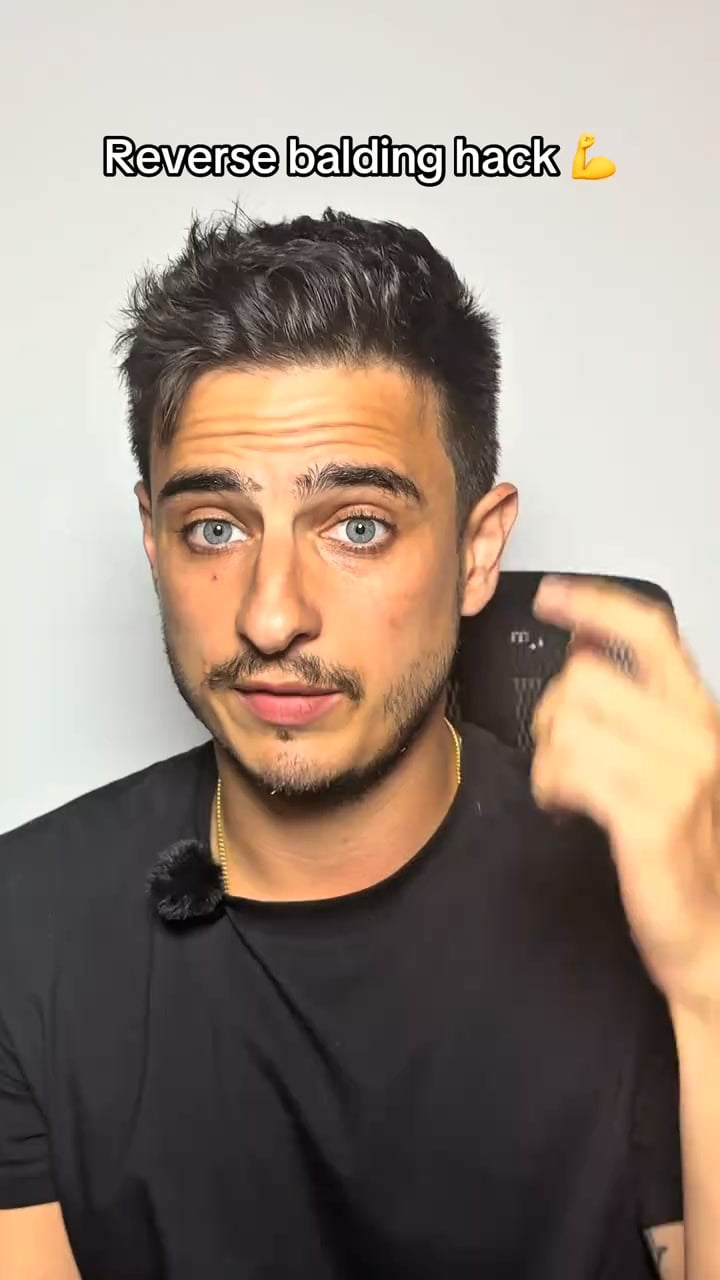 The serum that replaces minoxidil | 70% OFF Today