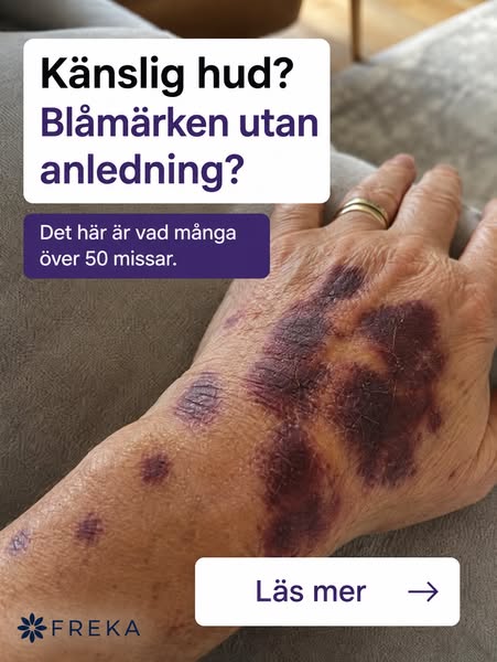 Blåmärkeskräm – Med arnica, vitamin K och ceramider