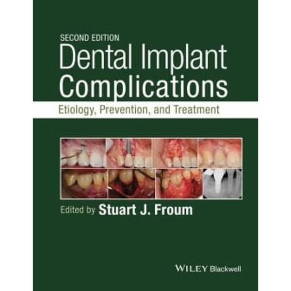 Dental Implant Complications: Etiology, Prevention, and Treatment, 2nd Edition