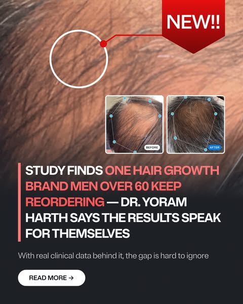 Best Hair Growth Products of 2026