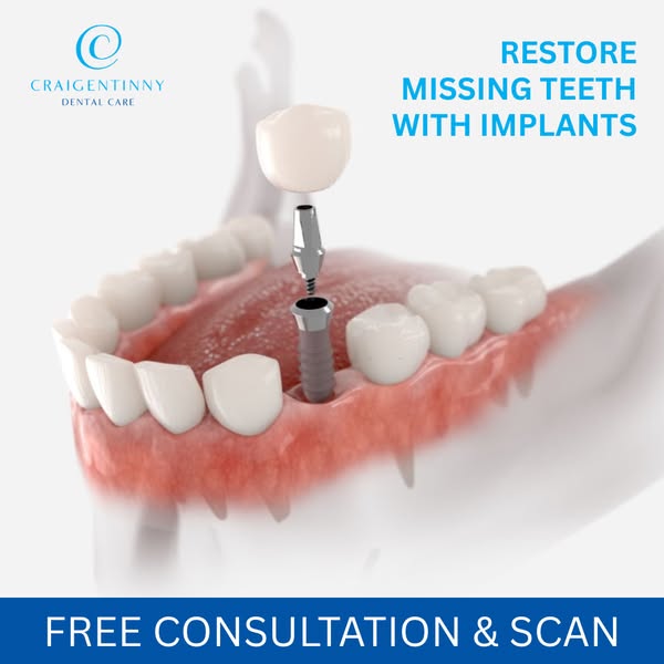 Restore Your Smile with Dental Implants