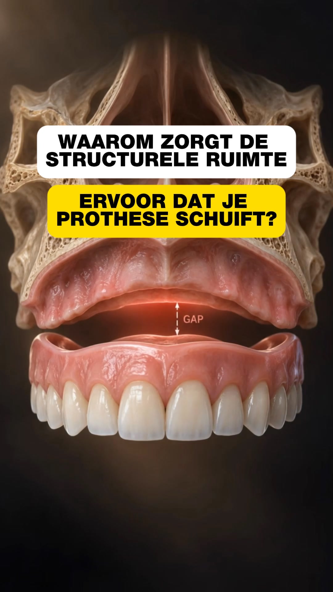 De Structurele Ruimte Die Crème Niet Kan Vullen