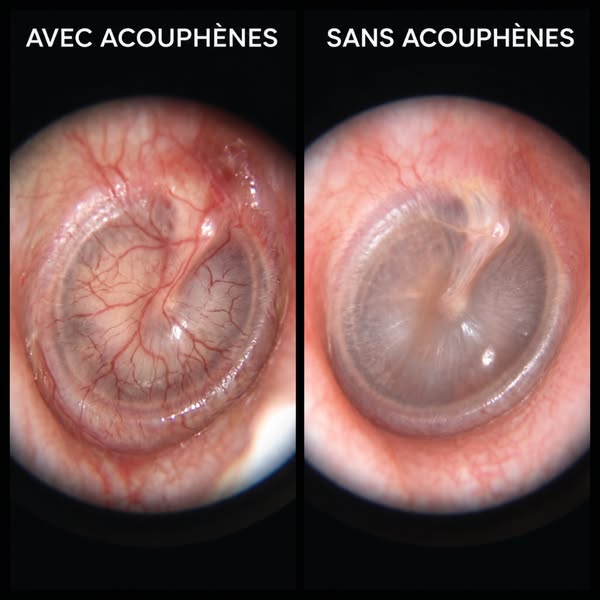 Lisez ceci si vos oreilles bourdonnent