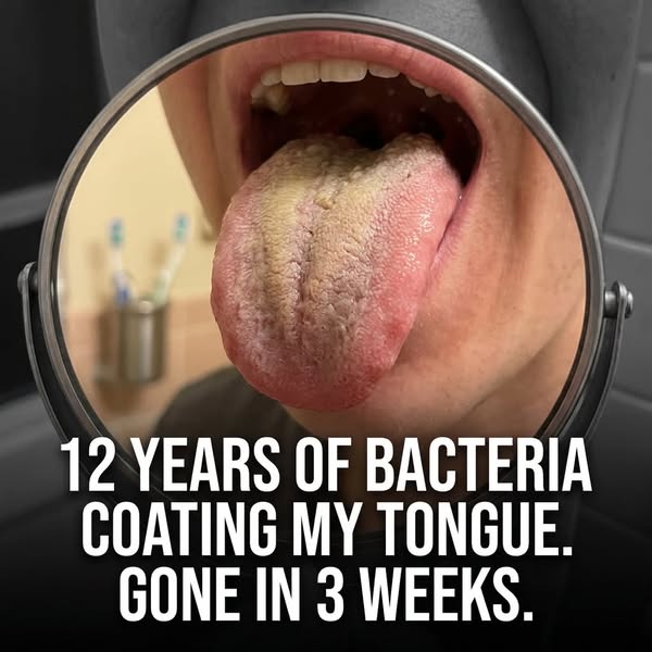 Your teeth are clean. Your throat isn’t.