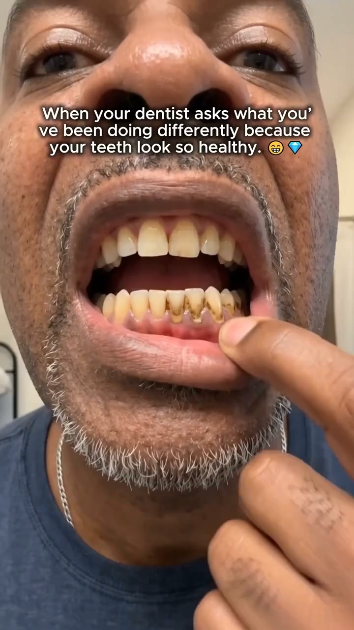 "What have you been doing differently?" My dentist was SHOCKED.