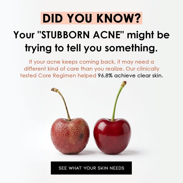 Maybe It Isn’t Just Stubborn Acne