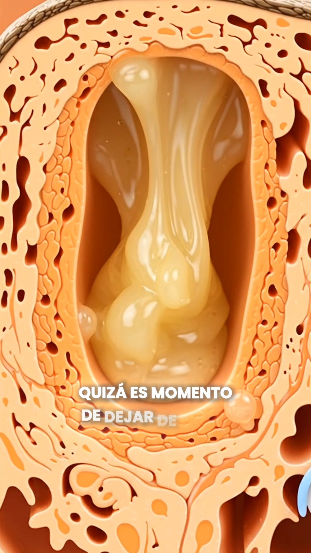 Solución en 5 minutos para orzuelos