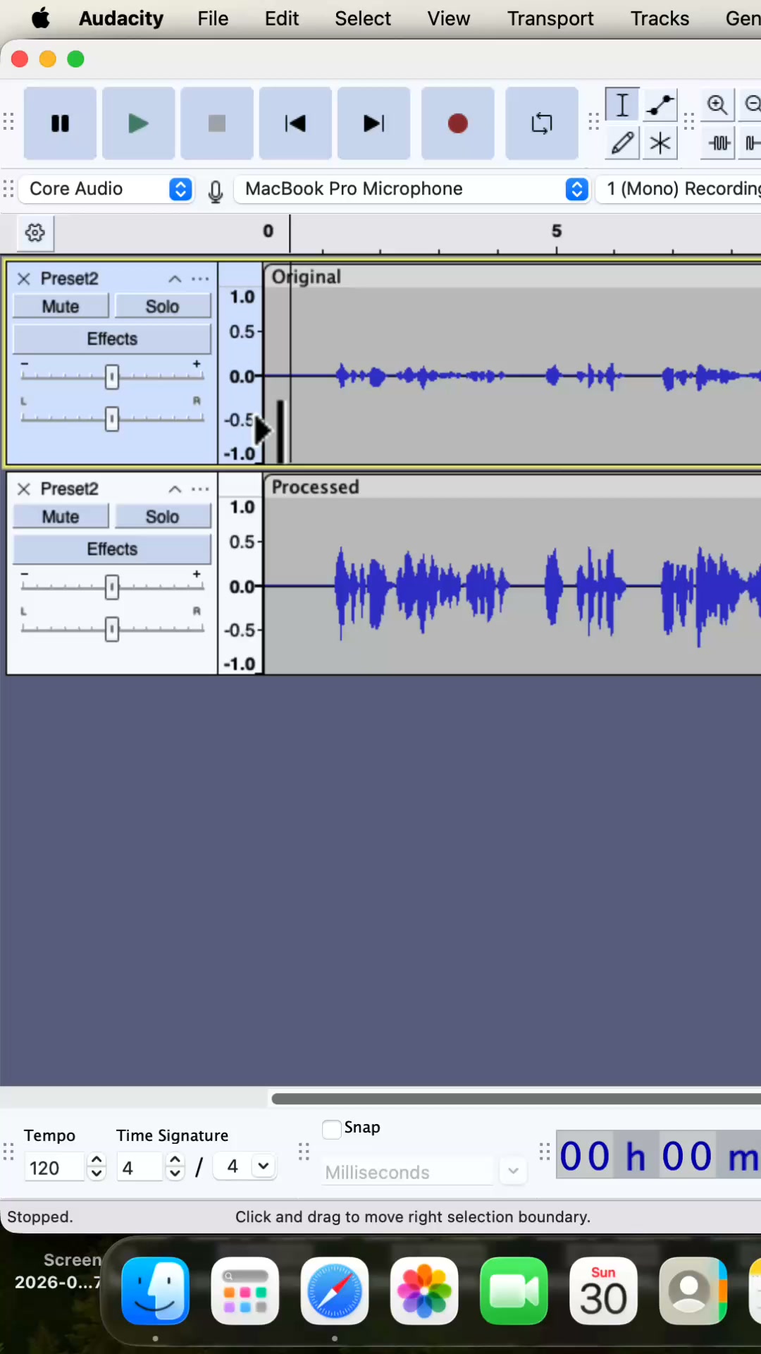 $3 - Fix Your Audio in 5 Simple Steps