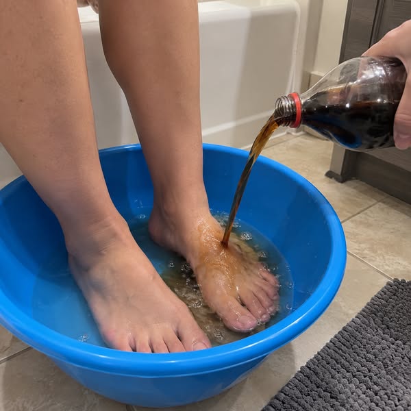 This Easiest Way To Get Rid Of Nail Fungus Naturally