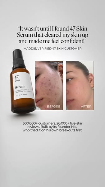 A skin treatment that actually works