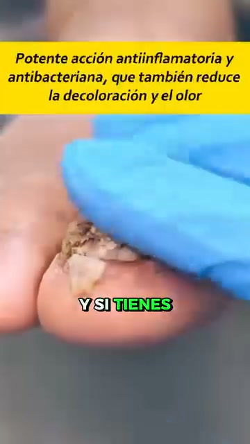 OFERTA 2X1