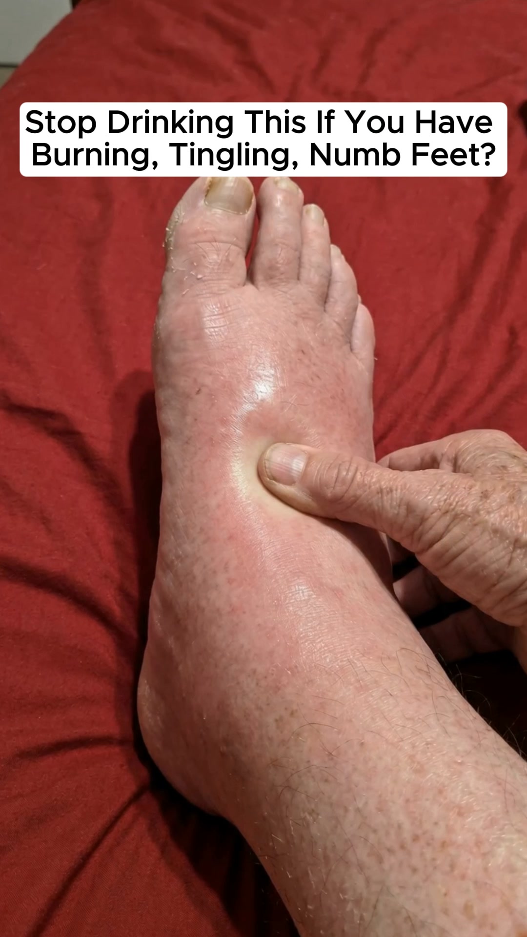 "12 years of neuropathy pain gone in a few minutes"