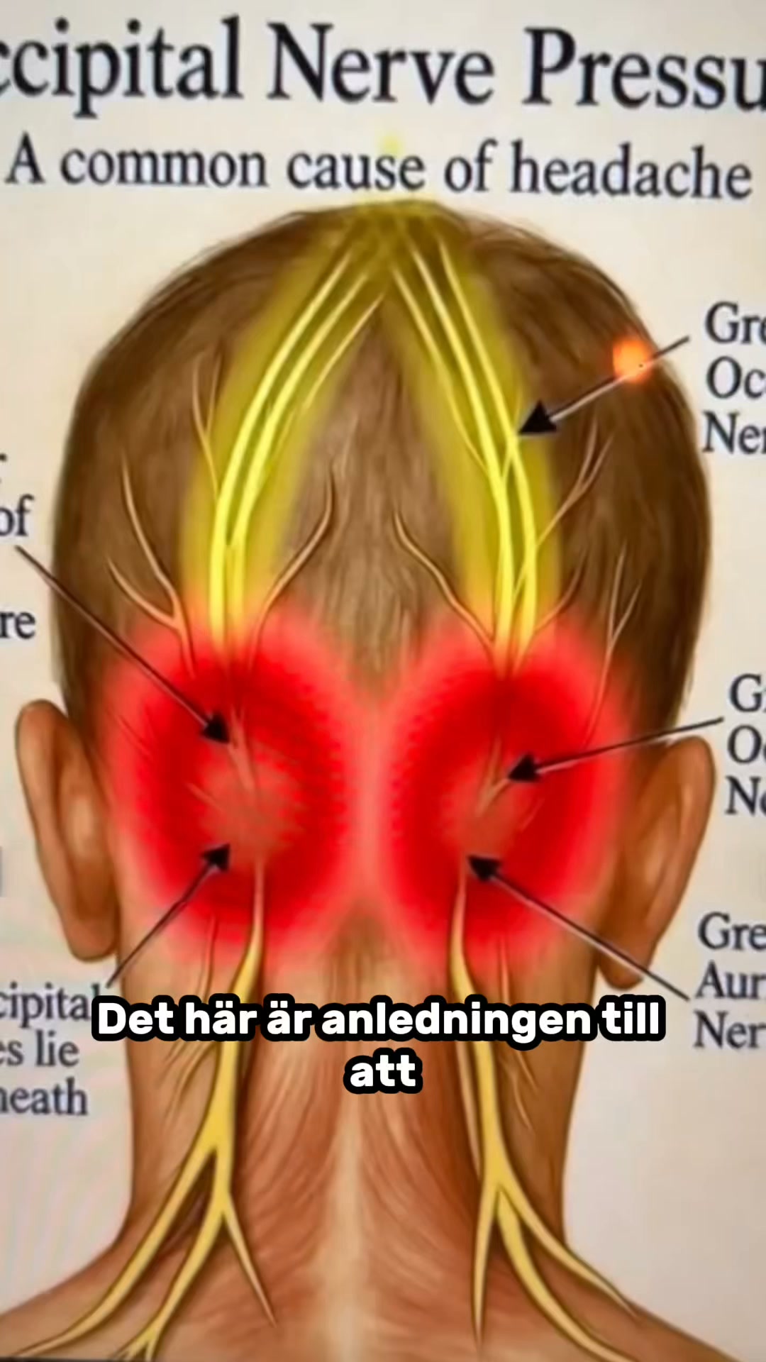 Lindra smärtan i nacken