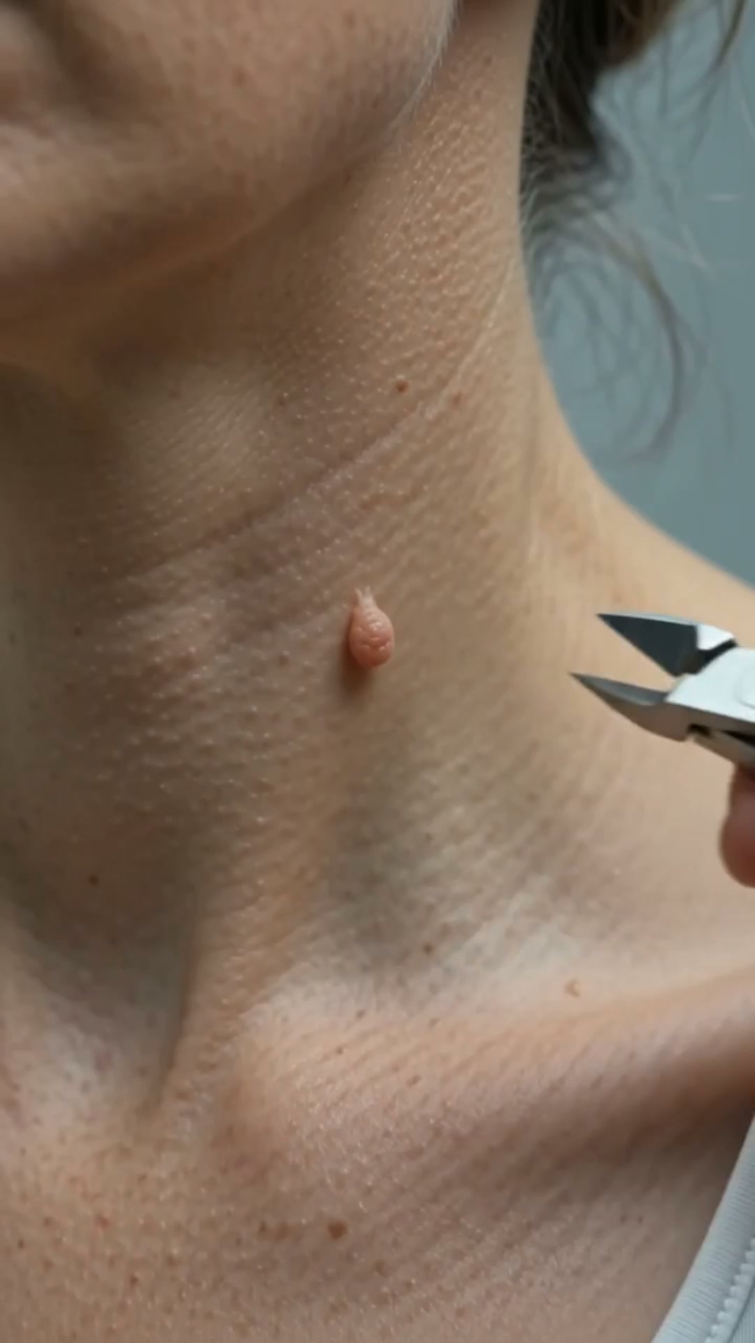 Anúncio de DermaVita Pflege
