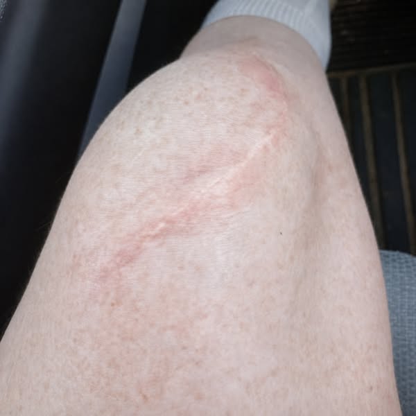 Knee Pain? Read this