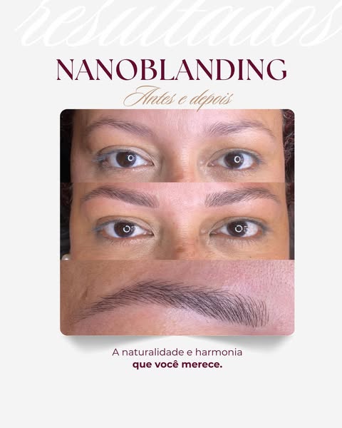 Entenda todos os detalhes
